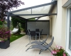 Pose de pergola en Vendée par Espace Confort 2000